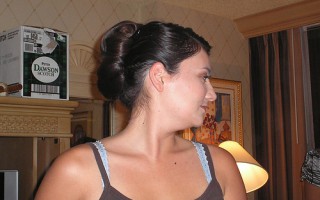Permanent Link to Mám jizvy po akné! Pomoc!